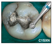 Edenta Rosenbohrer C1SXN, 5 Stk.